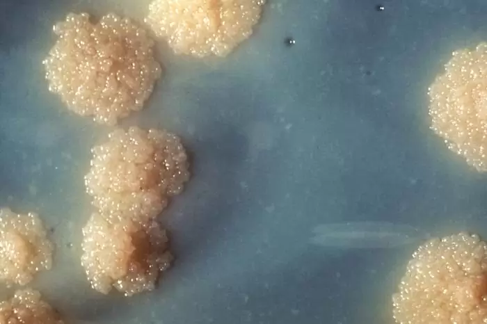 Колонии бактерии M. tuberculosis, вызывающей туберкулез