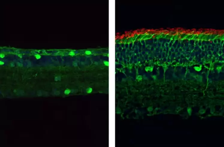 Ученые смогли восстановить зрение у слепых мышей c помощью генной инженерии