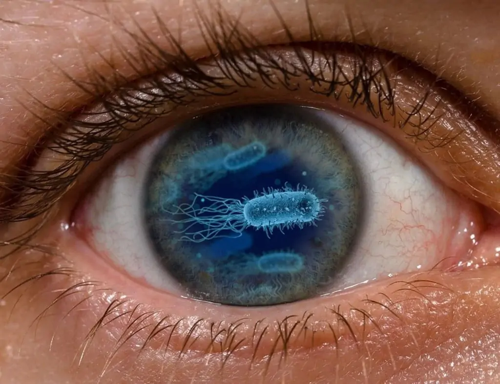 Некоторые случаи слепоты связаны с бактериями в кишечнике